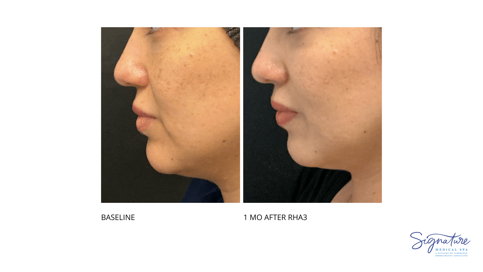 Before and After Image: RHA3